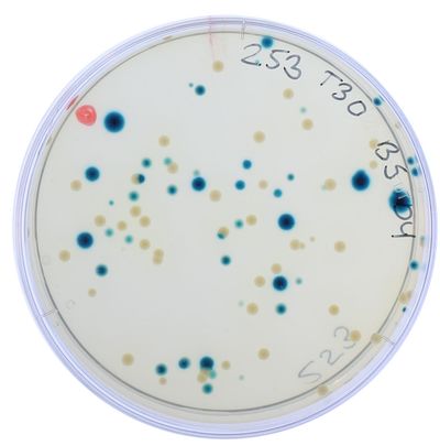 Bacterial colonies growing on an agar plate